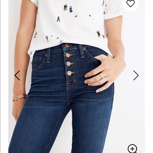 Madewell 9” High Rise Skinny Buttonfly Jeans